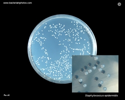 staph epidermidis on tryptic agar